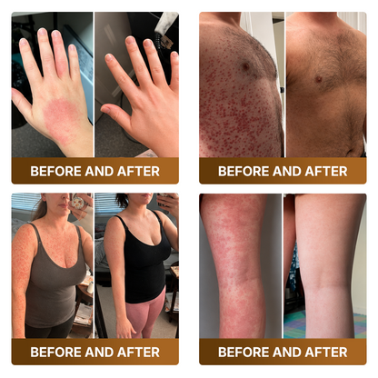 𝑷𝒓𝒐𝒎𝒐𝒕𝒊𝒐𝒏 𝒊𝒏 𝒕𝒉𝒆 𝒍𝒂𝒔𝒕 30 𝒎𝒊𝒏𝒖𝒕𝒆𝒔!  𝐷𝑂𝘊𝑇𝘐𝐴® 𝐵𝘦𝘦 𝑽𝒆𝒏𝙤𝙢