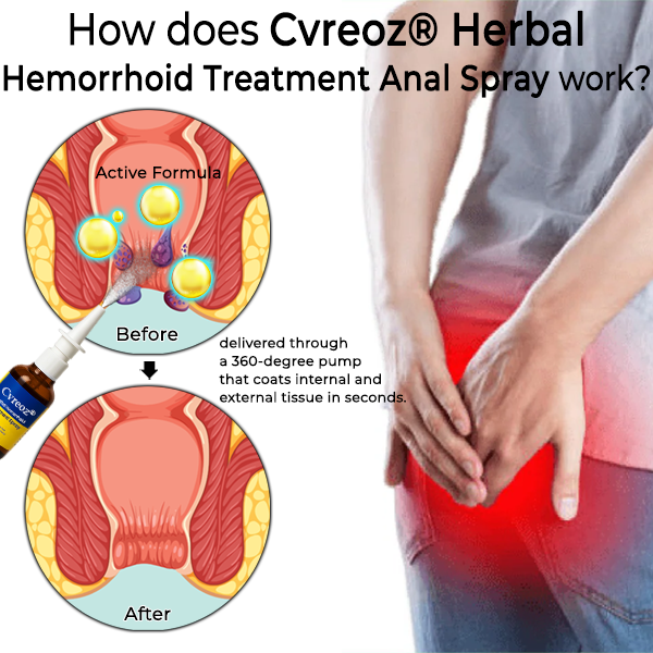 Cvreoz🗽Herbal Hemorrhoid Treatment Anal Spray Pro(⏰ Last 30 Minutes ⏰)