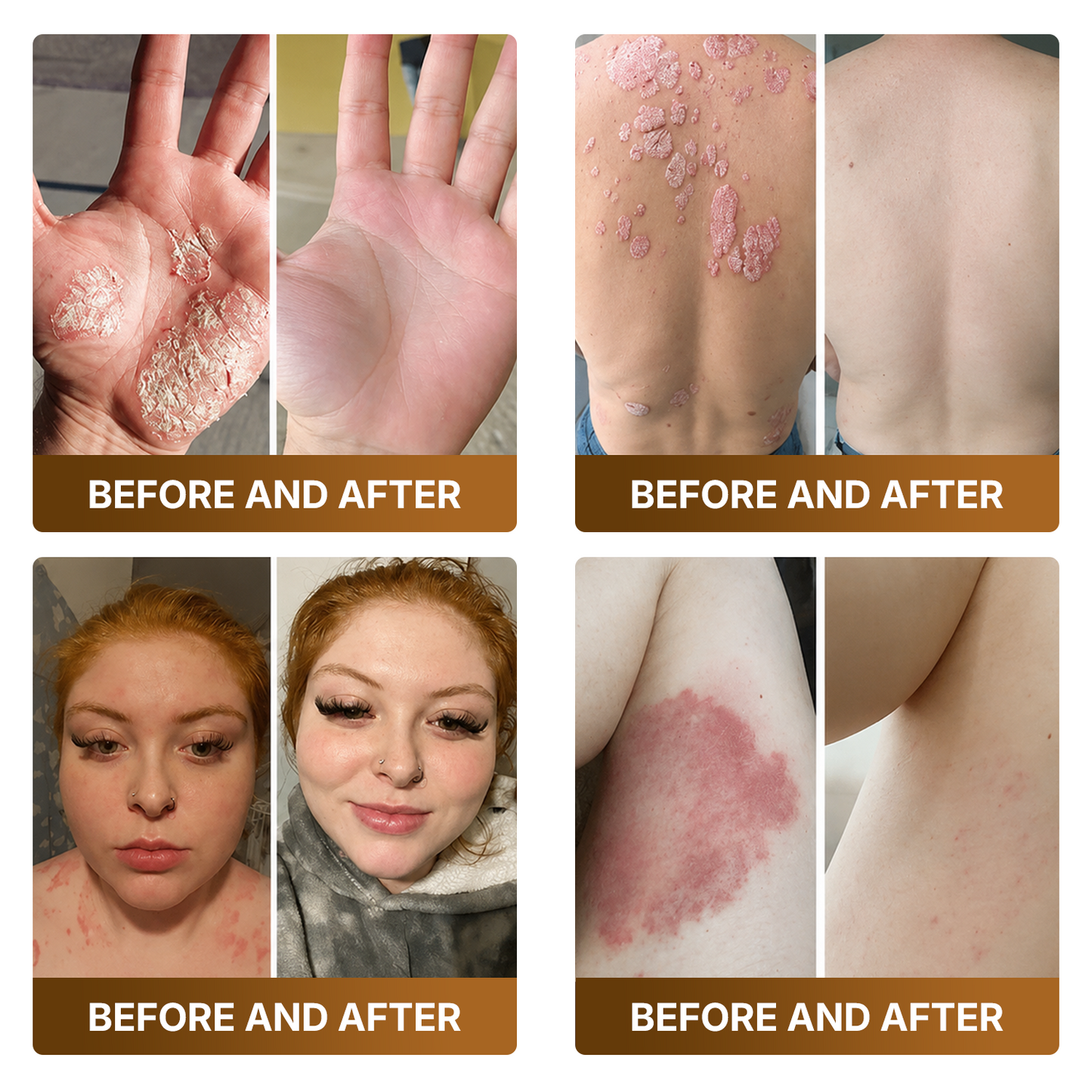 𝑷𝒓𝒐𝒎𝒐𝒕𝒊𝒐𝒏 𝒊𝒏 𝒕𝒉𝒆 𝒍𝒂𝒔𝒕 30 𝒎𝒊𝒏𝒖𝒕𝒆𝒔!  𝐷𝑂𝘊𝑇𝘐𝐴® 𝐵𝘦𝘦 𝑽𝒆𝒏𝙤𝙢