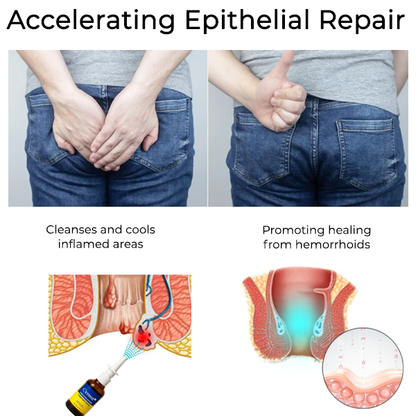 Cvreoz🗽Herbal Hemorrhoid Treatment Anal Spray Pro(⏰ Last 30 Minutes ⏰)