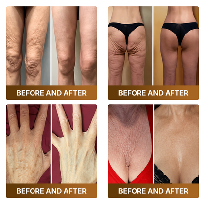 𝑷𝒓𝒐𝒎𝒐𝒕𝒊𝒐𝒏 𝒊𝒏 𝒕𝒉𝒆 𝒍𝒂𝒔𝒕 30 𝒎𝒊𝒏𝒖𝒕𝒆𝒔!  𝐷𝑂𝘊𝑇𝘐𝐴® 𝐵𝘦𝘦 𝑽𝒆𝒏𝙤𝙢